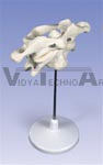 Atlas and axis cervical vertebrae model wire mounted together on removable stand